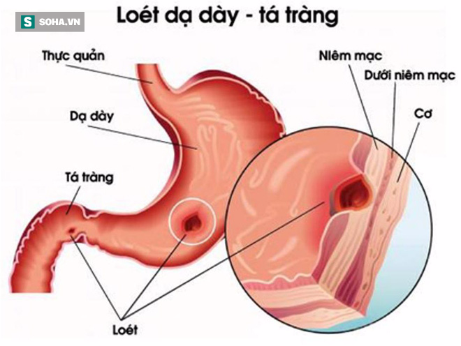 Ăn tối sai cách có thể gây ra 9 loại bệnh nguy hiểm - Ảnh 2.