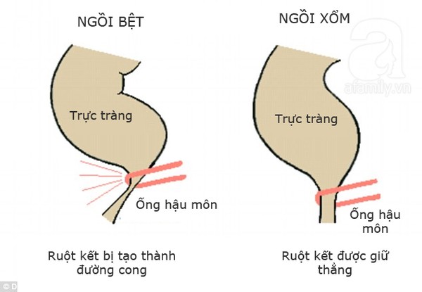 Video hướng dẫn cách ngồi vệ sinh đúng tư thế - Ảnh 2.