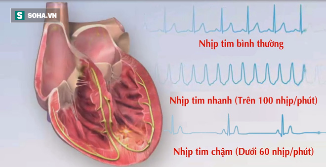 3 dấu hiệu đơn giản tự nhận biết bạn có thể sống thọ hay không - Ảnh 1.