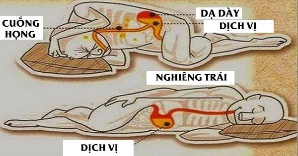 Đây là lí do tại sao bạn nên nằm ngủ nghiêng về bên trái ngay tối nay - Ảnh 1.