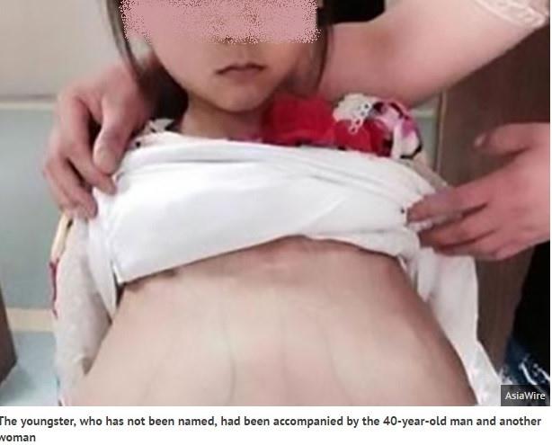 Bé gái 12 tuổi mang thai ở Trung Quốc nghi là bị bắt cóc từ Việt Nam - Ảnh 1.