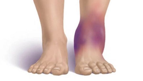 9 triệu chứng của bệnh thận bạn nhất định không được bỏ qua - Ảnh 2.