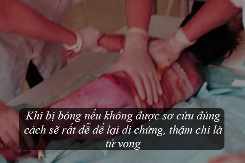 Chuyên gia hướng dẫn cách sơ cứu đơn giản, hiệu quả khi trẻ bị bỏng - Ảnh 2.