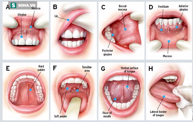 Mắc bệnh đơn giản 2 tháng chưa khỏi, không ngờ chính là dấu hiệu của ung thư đã phát triển - Ảnh 3.