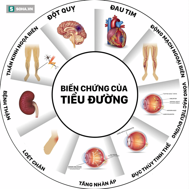 PGĐ BV Nội tiết Trung ương: Căn bệnh nguy hiểm đe dọa trẻ em do thói quen của bố mẹ - Ảnh 2.