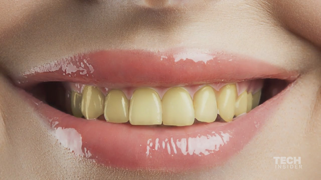 Dùng kem đánh răng hàng ngày mà răng vẫn vàng ố, nghe nha sĩ Mỹ chia sẻ 3 cách làm trắng răng tức thì - Ảnh 1.