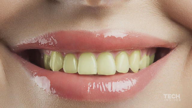 Dùng kem đánh răng hàng ngày mà răng vẫn vàng ố, nghe nha sĩ Mỹ chia sẻ 3 cách làm trắng răng tức thì - Ảnh 2.