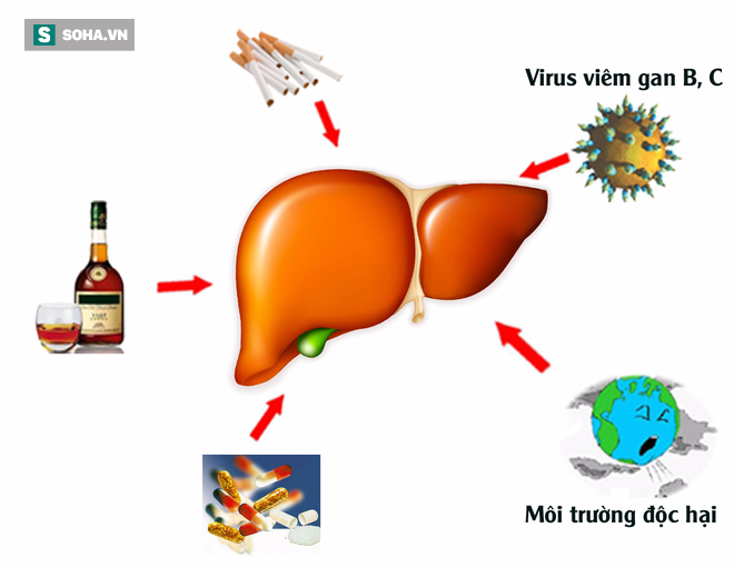 Cách tự xem gan của bạn khỏe hay yếu chỉ trong 1 phút - Ảnh 2.