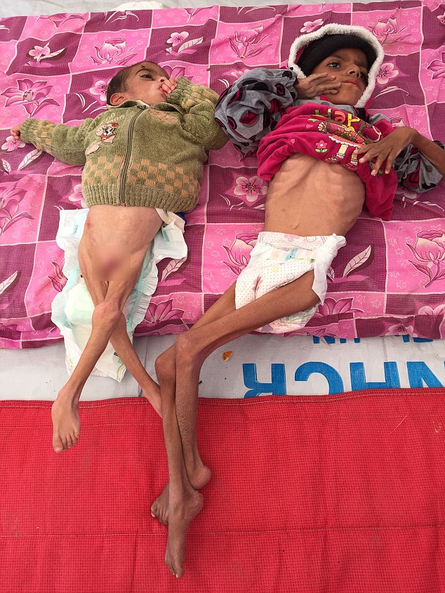 Hình ảnh 2 em bé da bọc xương chờ chết vì đói tại Iraq ám ảnh cả thế giới - Ảnh 1.