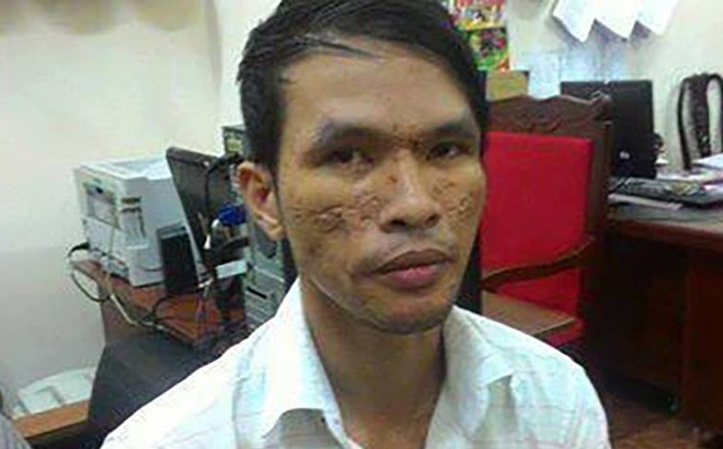 Kẻ bạo hành, chích điện vào bé trai Campuchia bị xử lý thế nào? - Ảnh 1.
