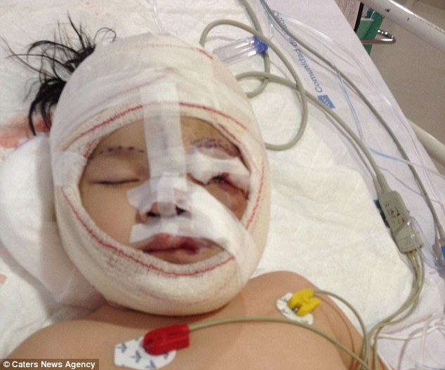 Cô bé người Việt mang khối u che hết nửa gương mặt bất ngờ được một người phụ nữ Mỹ cứu giúp - Ảnh 2.