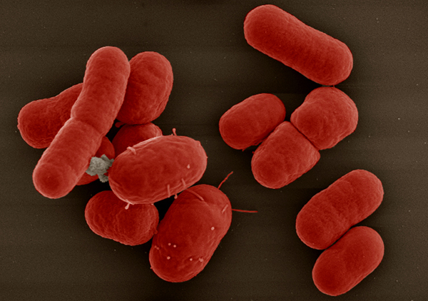 10 vi khuẩn cần phải đề phòng khi thời đại kháng kháng sinh đã đến - Ảnh 2.