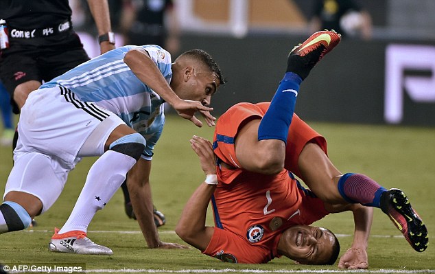 Chân trái Alexis Sanchez sưng phồng kinh dị sau cú đạp của đối thủ - Ảnh 3.