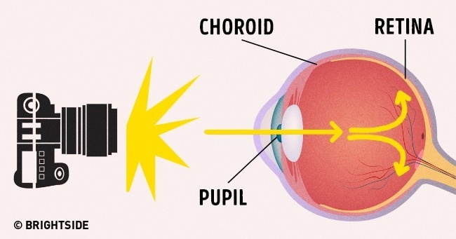 Tại sao ở ngoài mắt nâu mà sao chụp ảnh lại đỏ quạch như ma cà rồng? Lý do đây rồi! - Ảnh 2.
