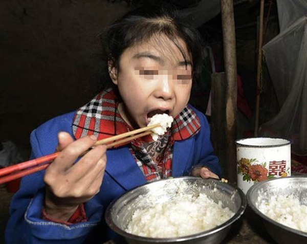 Kỳ lạ bé gái 15 tuổi mỗi ngày ăn 7kg gạo nhưng không mập lên nổi - Ảnh 2.