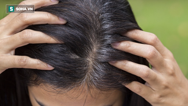 Nhìn tóc cũng có thể đoán ra cơ thể bạn đang mắc bệnh - Ảnh 4.