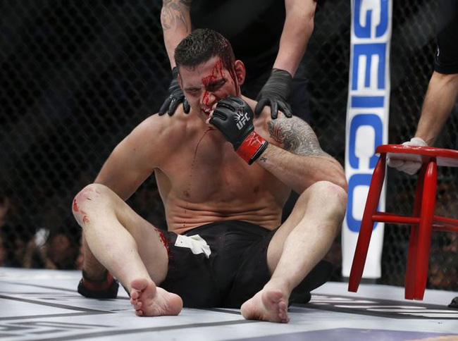Nhà cựu vô địch UFC đầm đìa máu sau cú bay người lên gối tàn khốc của đối thủ - Ảnh 3.