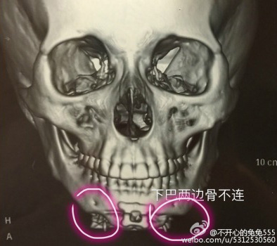 Câu chuyện cô gái đi phẫu thuật thẩm mỹ bị bác sĩ cưỡng hiếp nhiều lần gây chấn động mạng xã hội Trung Quốc - Ảnh 3.