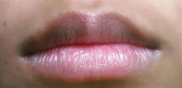 Nhìn sắc môi có thể đoán biết ngay tình trạng sức khỏe của cơ thể bạn ra sao - Ảnh 3.