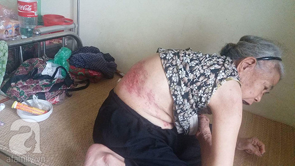 Hà Nội: Mẹ già 81 tuổi tố bị con trai út đánh gãy xương sườn, đuổi khỏi nhà - Ảnh 2.