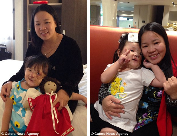 Cô bé người Việt mang khối u che hết nửa gương mặt bất ngờ được một người phụ nữ Mỹ cứu giúp - Ảnh 4.