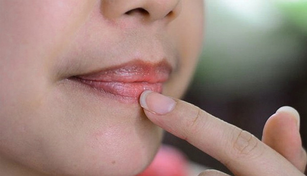 Nhìn sắc môi có thể đoán biết ngay tình trạng sức khỏe của cơ thể bạn ra sao - Ảnh 4.