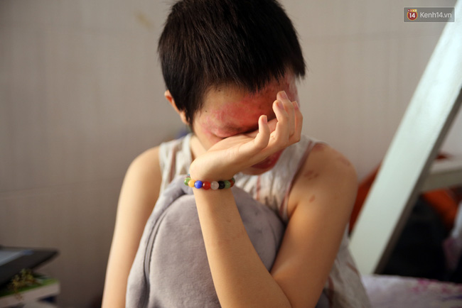 Nữ sinh từng bị tạt axit chấn động Sài Gòn: Em vẫn không hiểu mình đã làm gì sai... - Ảnh 4.