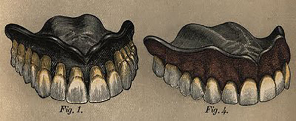 Răng tự phát nổ trong miệng? Câu chuyện có thật ở thế kỷ 19 - Ảnh 4.