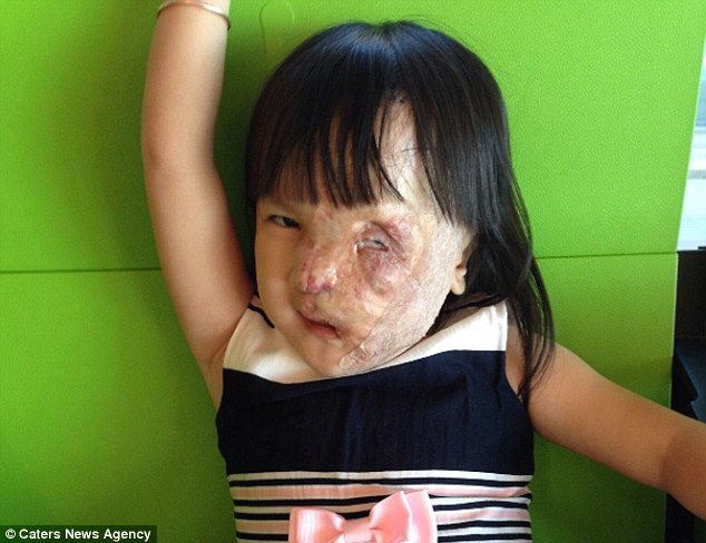 Cô bé người Việt mang khối u che hết nửa gương mặt bất ngờ được một người phụ nữ Mỹ cứu giúp - Ảnh 5.