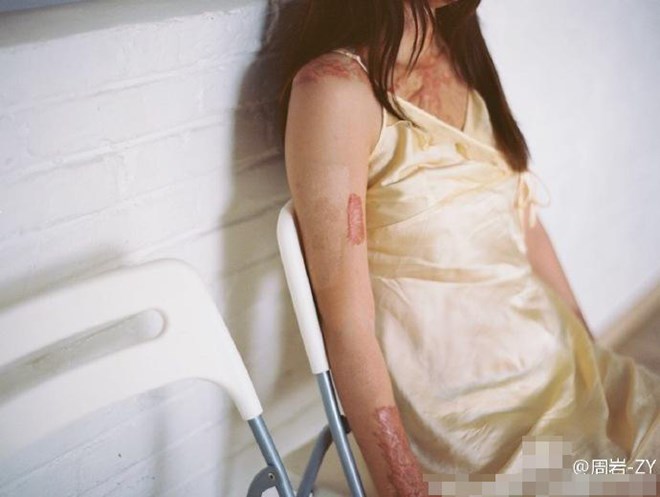 Bộ ảnh của cô gái bị bạn học tẩm xăng đốt gây sốt ở Trung Quốc - Ảnh 5.