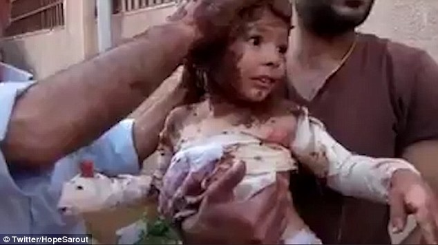 Đây là Syria, không phải Việt Nam - Loạt ảnh xé lòng về những đứa trẻ bị thiêu đốt trong trận không kích bằng napalm - Ảnh 6.