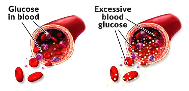 9 điều thực sự xảy ra bên trong cơ thể khi bạn ăn quá nhiều đường - Ảnh 7.