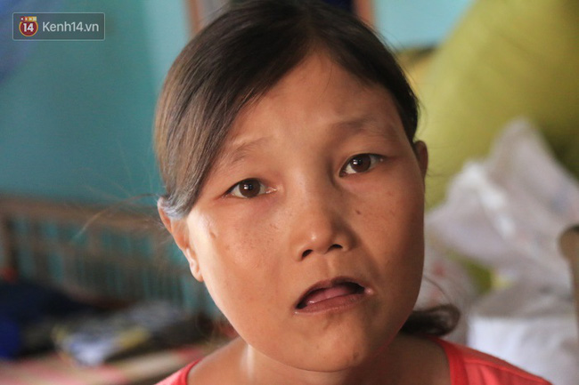 Cô gái mang khuôn mặt bà lão ở Quảng Nam: ăn gấp 10 lần người thường, uống mỗi ngày 36 lít nước - Ảnh 9.