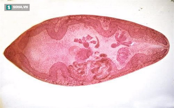 5 món ăn chứa nhiều ký sinh trùng đáng sợ nhất - Ảnh 8.