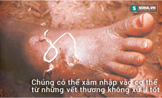 Sinh vật dài hàng mét này có thể đang ngụ trong cơ thể bạn - Ảnh 3.