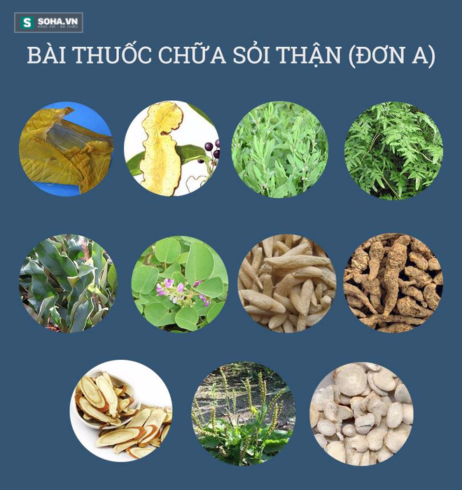 Bài thuốc chữa sỏi thận nổi như cồn vì chỉ mất 6 ngày là khỏi - Ảnh 1.