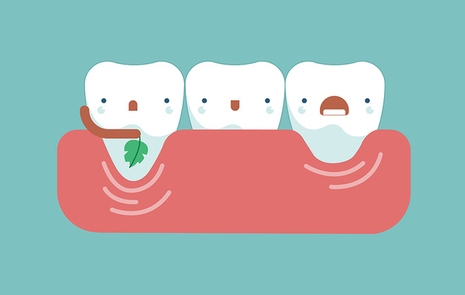 4 dấu hiệu âm thầm cảnh báo loãng xương, căn bệnh rất nhiều người mắc mà không biết - Ảnh 4.