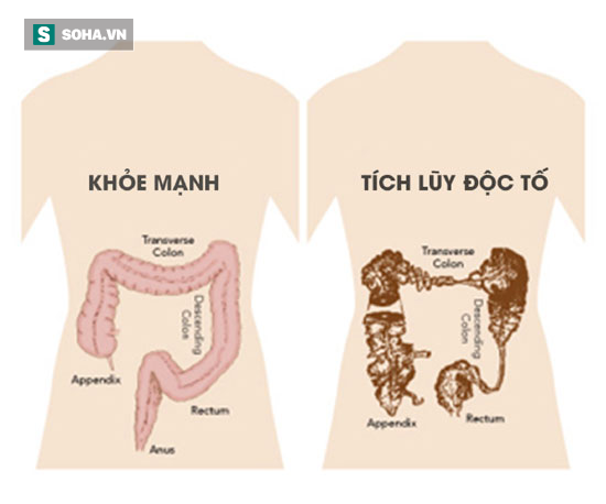 Lương y Nguyễn Hữu Khai: Muốn giải độc tố trong cơ thể phải biết đến 3 vị trí này - Ảnh 1.