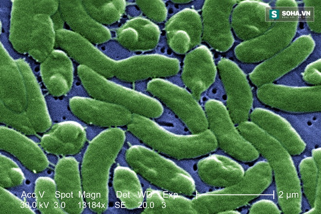 Vi khuẩn Vibrio đang tấn công nước Mỹ theo bụi sa mạc Sahara - Ảnh 2.