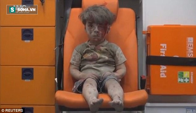 Cậu bé Syria khuôn mặt bê bết máu một năm trước giờ ra sao? - Ảnh 1.