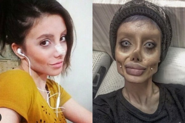 Having undergone surgery 50 times to look like Angelina Jolie, the young girl looks terrified like a zombie - Photo 1.