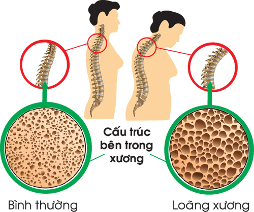 Canh xương hầm có chứa nhiều canxi không: Câu trả lời có thể khiến bạn bất ngờ - Ảnh 2.