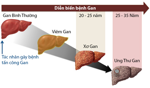 4 việc làm ngay để nuôi dưỡng một lá gan khoẻ mạnh - Ảnh 1.