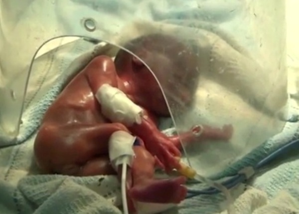 Vừa chào đời, bé sơ sinh đã suýt bị chôn sống vì phỏng đoán tắc trách của nhân viên y tế - Ảnh 2.