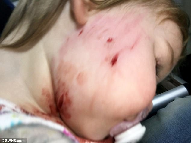 Bé gái 18 tháng tuổi bị chó cắn rách mặt, chủ chó thờ ơ đứng nhìn - Ảnh 2.
