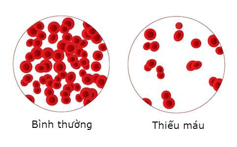 Khi gặp các triệu chứng thường gặp này, hãy đi khám thận trước khi quá muộn! - Ảnh 3.