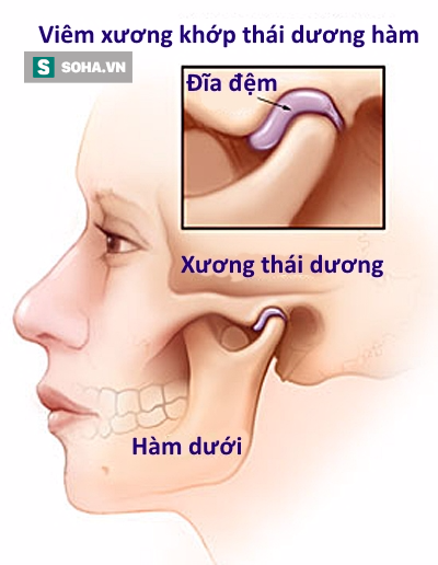 Lãnh hậu quả nặng nề vì một thói quen nhai từ trẻ em cho đến người lớn thường mắc - Ảnh 2.