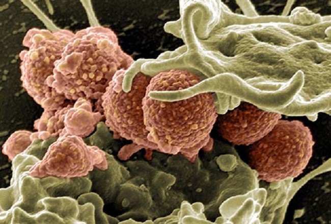 11 điều cơ bản cần biết về nhiễm khuẩn huyết - Ảnh 7.