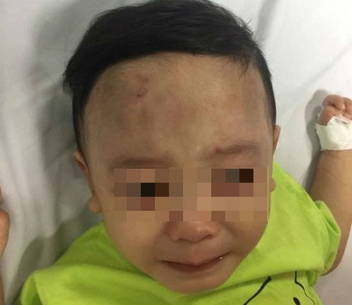 Vụ bỏ rơi bé 1 tuổi bị đánh tổn thương não: Công an giăng lưới 5 đối tượng tại bệnh viện - Ảnh 2.
