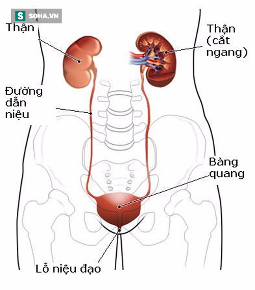 3 dấu hiệu cảnh báo nhiễm trùng thận: Nắm vững để không gặp hậu quả nặng nề - Ảnh 3.